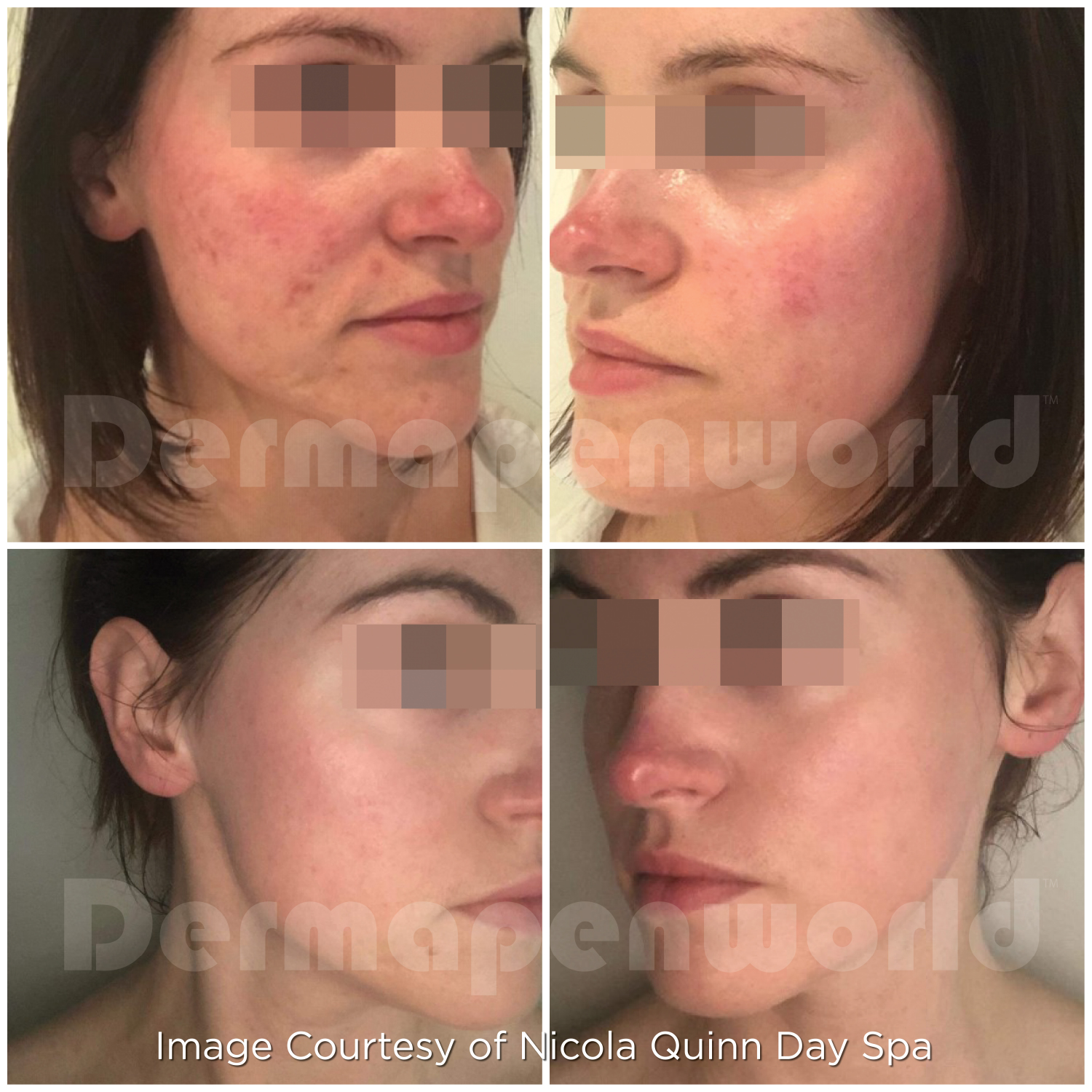 Before and After - Mixed Concerns