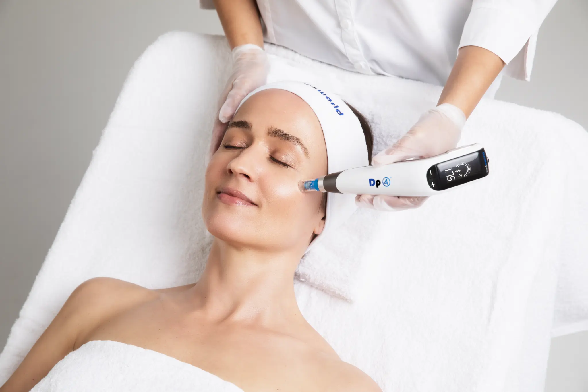Microneedling